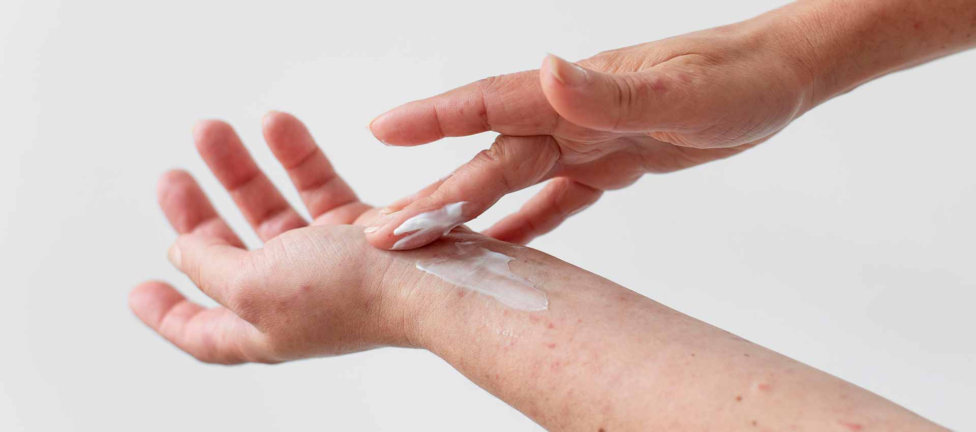 Atopowe zapalenie skóry – fakty i mity o AZS